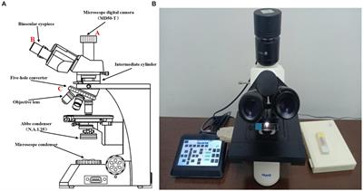 Focus prediction of medical microscopic images based on Lightweight Densely Connected with Squeeze-and-Excitation Network